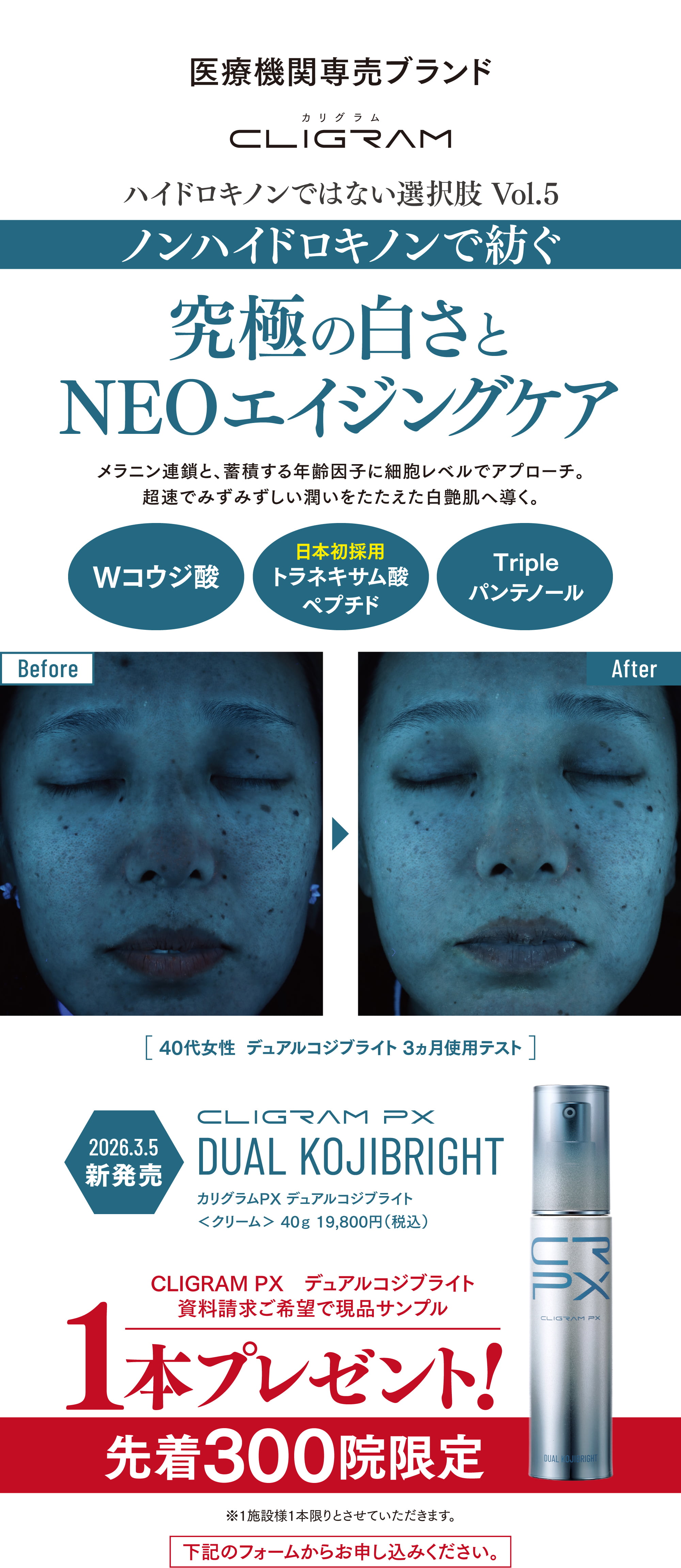 医療機関専売CLIGRAM「ノンハイドロキノンで紡ぐ 究極の白さとNEOエイジングケア」デュアルコジブライト（2026.3.5新発売）Before/After画像・先着300院限定で現品サンプル1本プレゼント告知